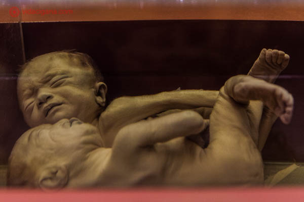 Doi fetos bem preservados expostos no War Remnants Museum, na Cidade de Ho Chi Minh, no Vietnã. Esses fetos são deformados devido a exposição ao agente laranja, presente na bomba de napalm.